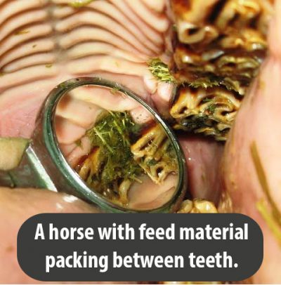 food between teeth