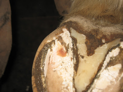 Draining abscess in the bar