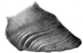 Laminitic rings distorting the hoof capsule