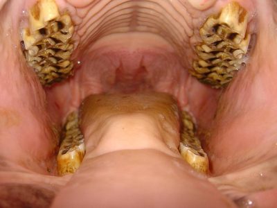 Normal equine mouth