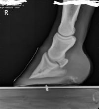 Normal radiographs